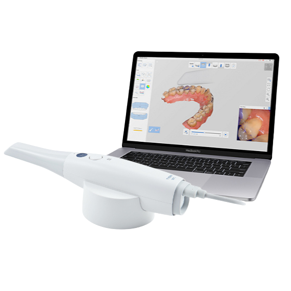 Intraoralscanner